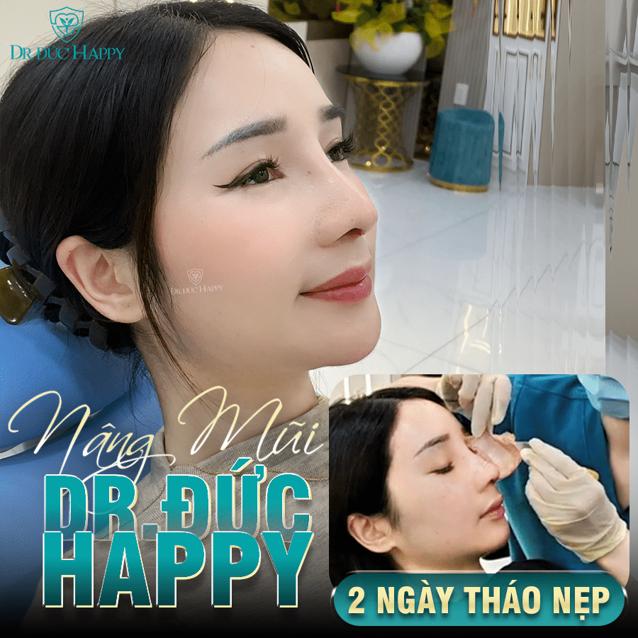 Bác sĩ nâng mũi giỏi