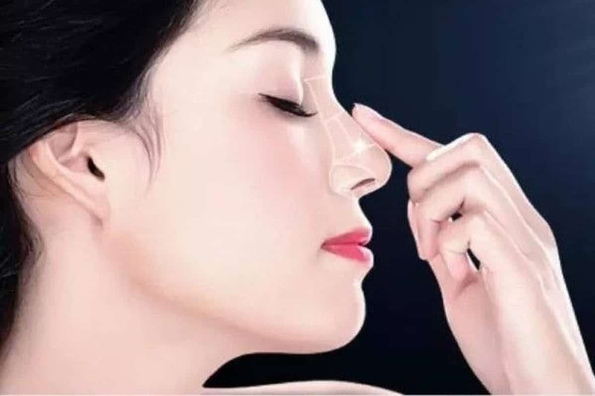tháo nẹp mũi sau một tuần có được không