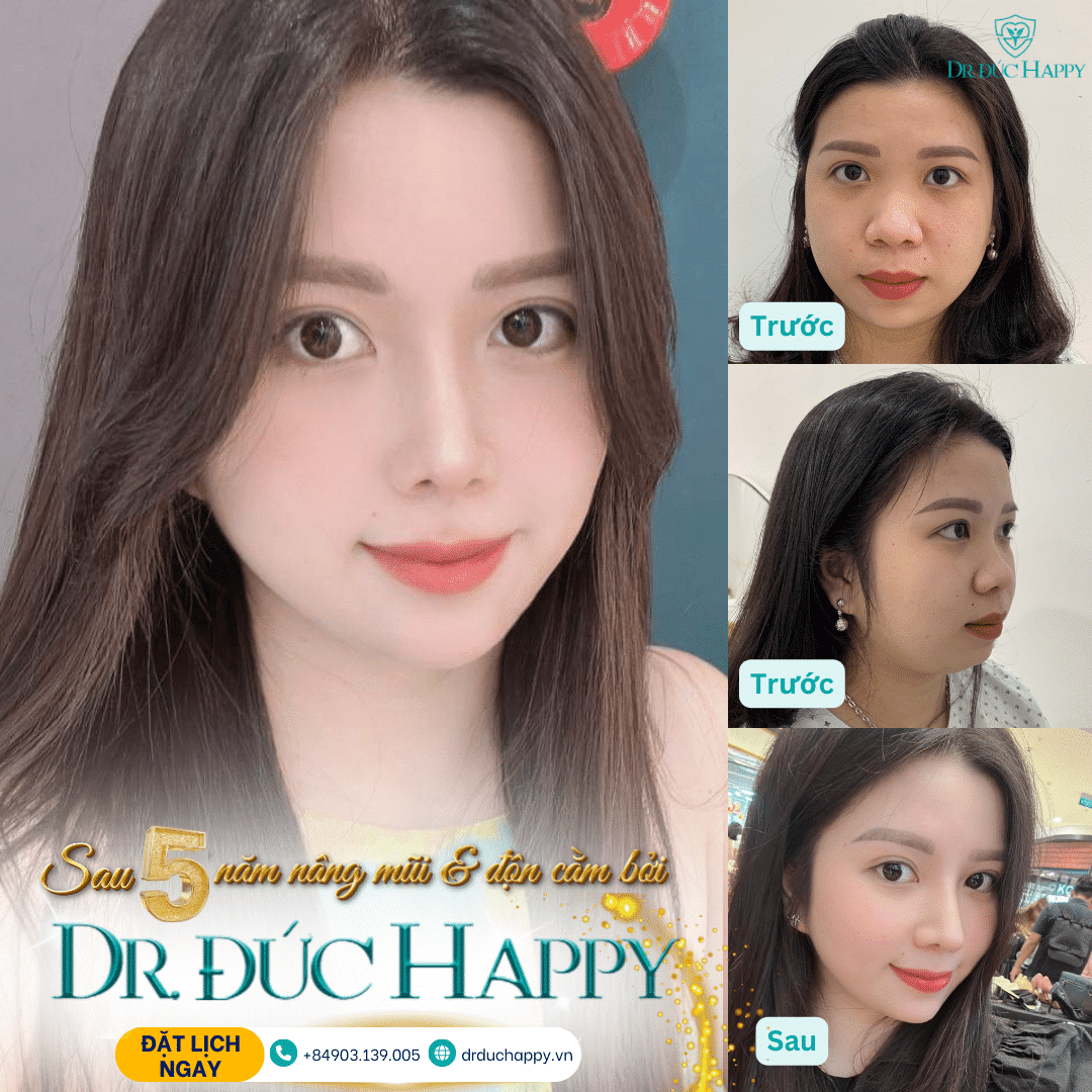 Bác sĩ phẫu thuật sửa mũi hỏng